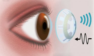 Kontaktlinse gegen Grünen Star